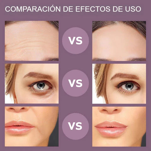 LIFTING PRO Masajeador de Rejuvenecimiento Facial